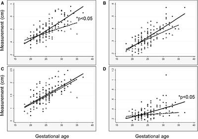 Expected small left heart size in the presence of congenital diaphragmatic hernia: Fetal values and Z-scores for infants confirmed to have no heart disease postnatally